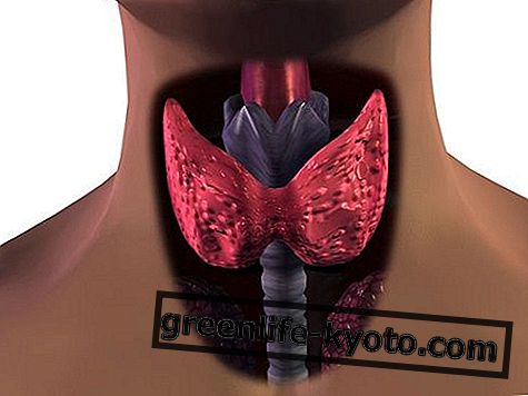 Setas para la tiroiditis de Hashimoto: cuáles usar