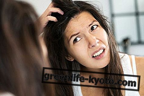 Hair with dandruff: causes, treatments and natural remedies